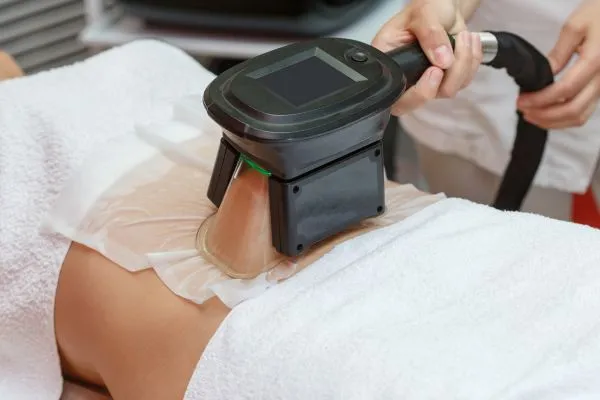 Image of person having fat freezing treatment to help weight gain Barnsley