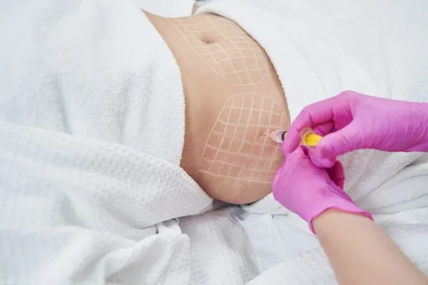 image of fat dissolving injections on love handles to help combat weight gain Barnsley