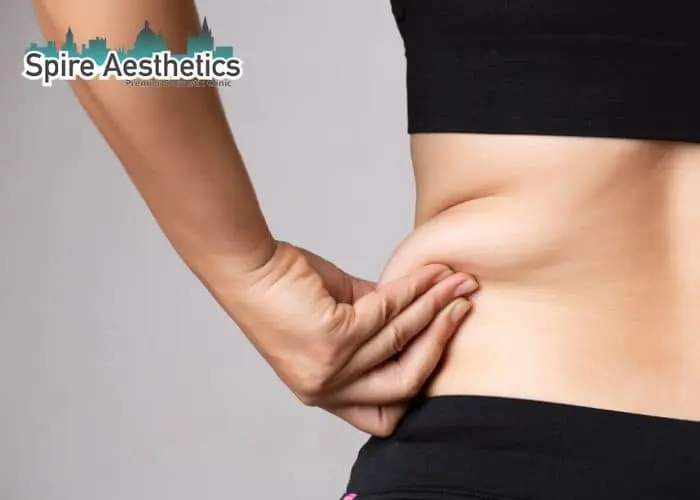 Image of woman pinching fat on their hips Barnsley. Fat Freezing treatment